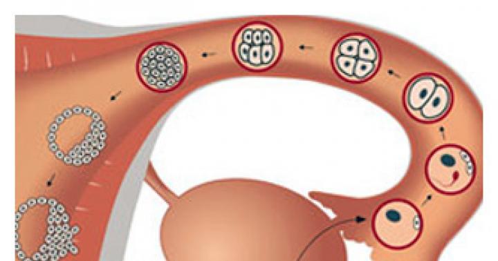 Gjithçka rreth apopleksisë ovariane: simptomat e para, shkaqet dhe metodat aktuale të trajtimit