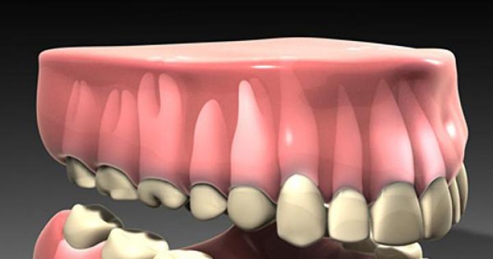 Πόσα δόντια έχει ένα άτομο, οδοντιατρική φόρμουλα
